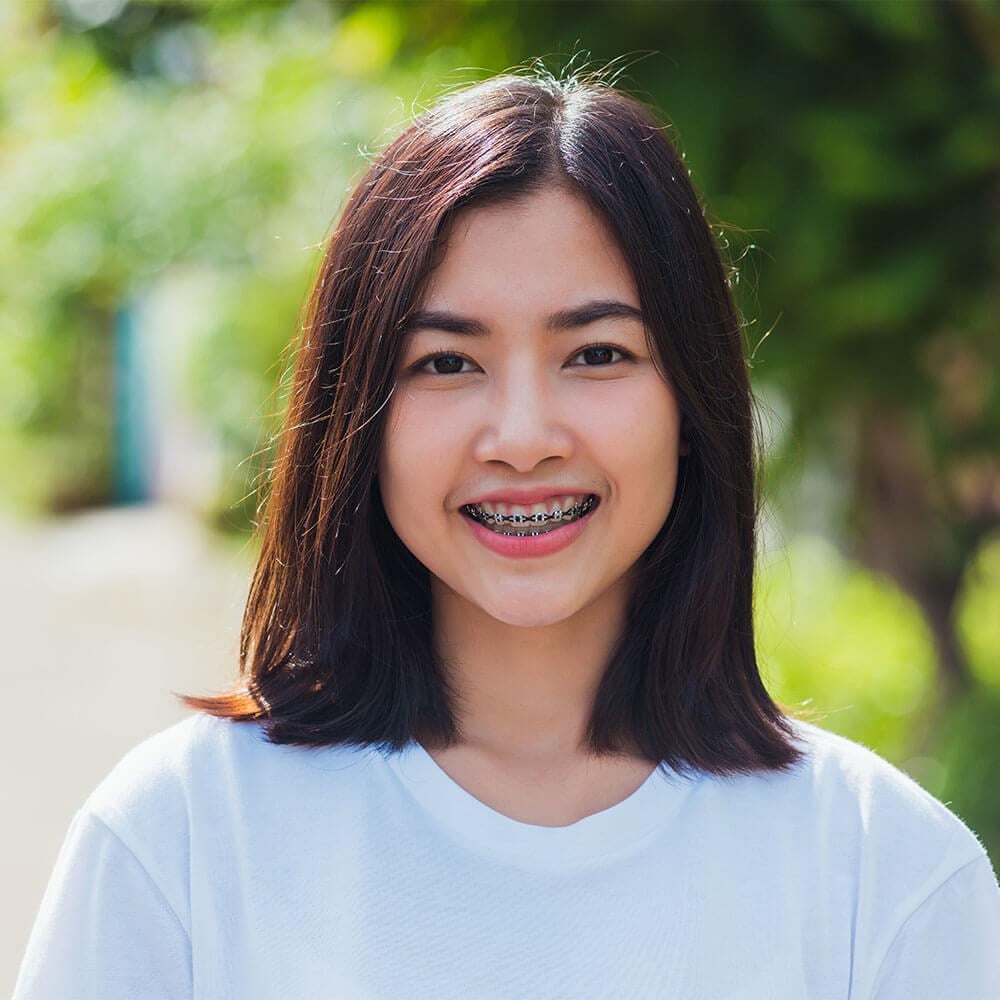 Braces