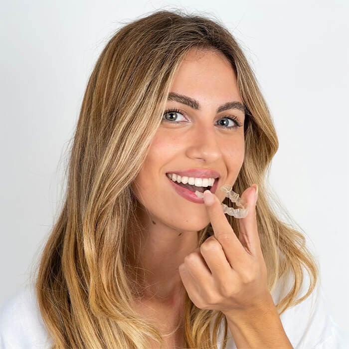 Invisalign Aligners